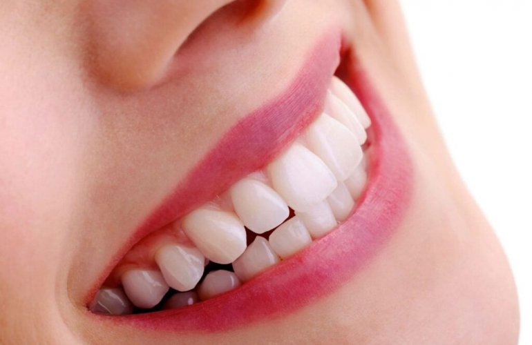 Ankara Ortodonti tedavisi